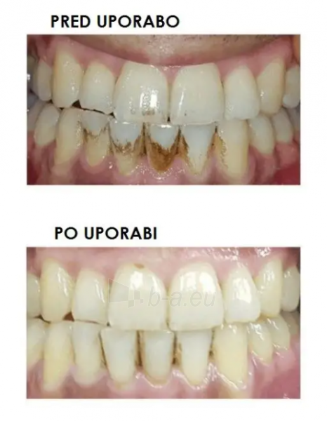 Dantų valymo šepetėlis Silkn ToothWave TW1PE3001 paveikslėlis 4 iš 8